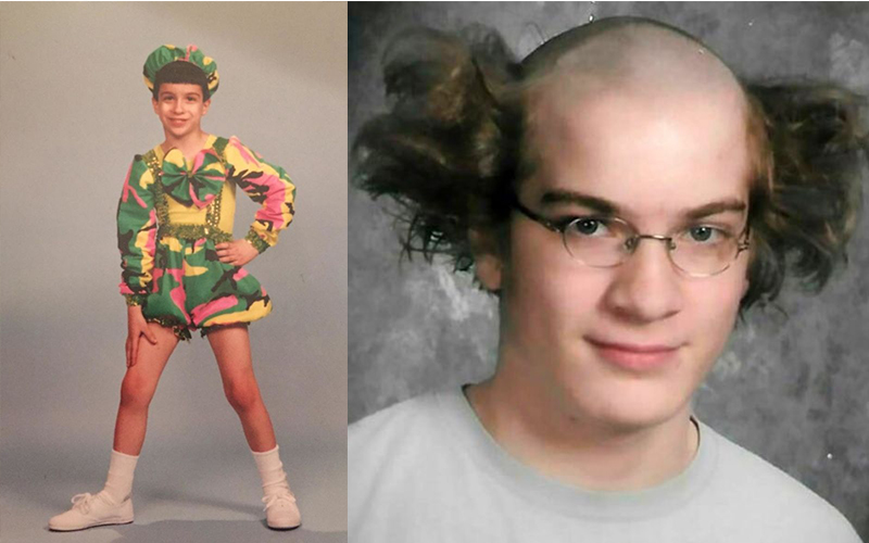 Most Embarrassing Childhood Photos